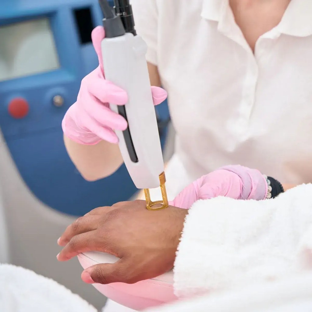 Laser Hair Removal Fayetteville, AR