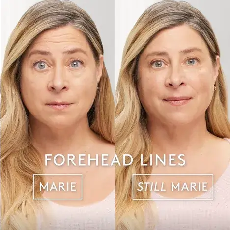 botox fayetteville ar