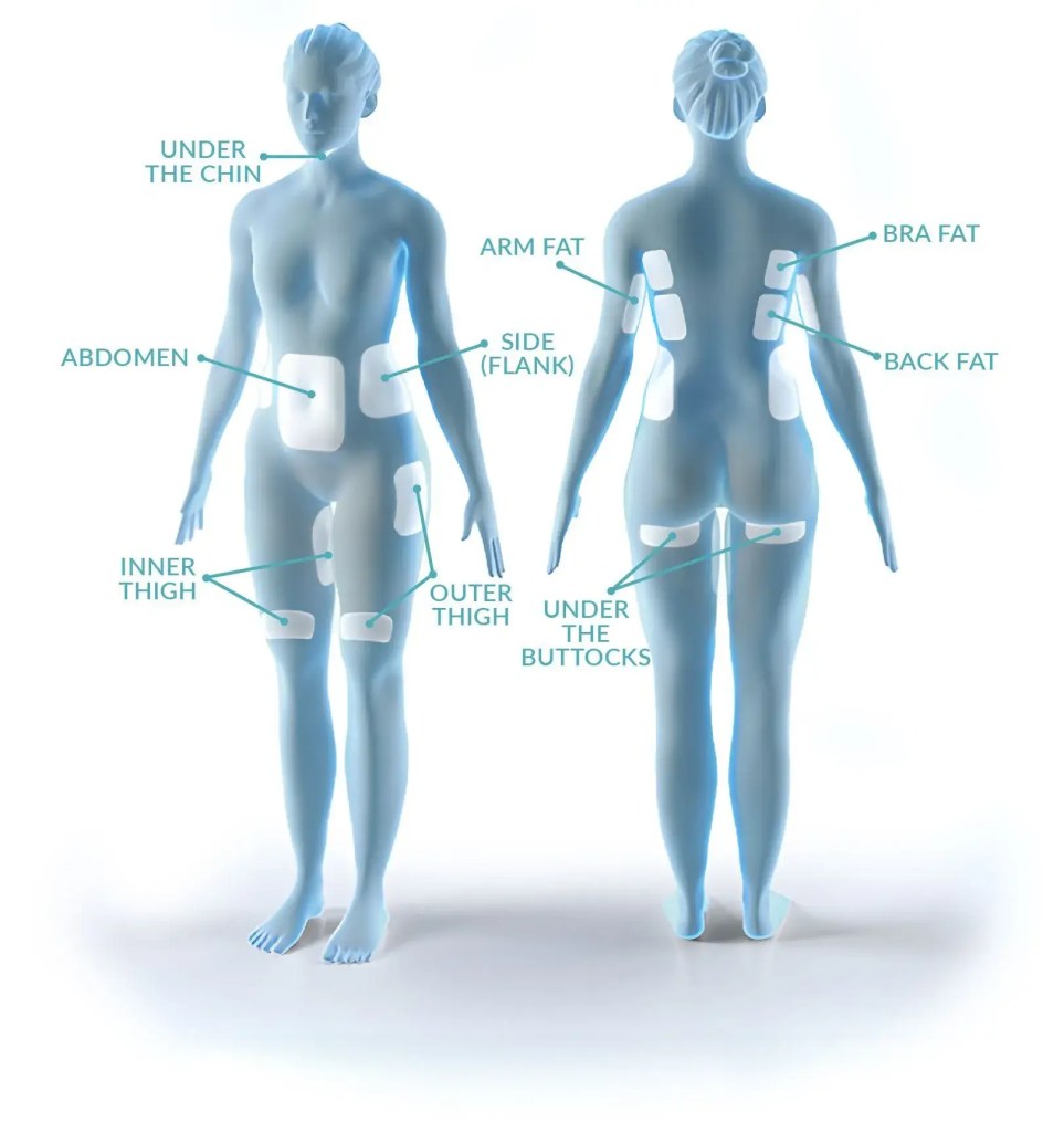 treatment areas Coolsculpting & Fat Removal